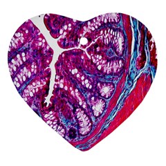 Histology Inc Histo Logistics Incorporated Masson s Trichrome Three Colour Staining Ornament (heart) by Mariart