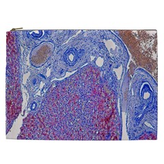 Histology Inc Histo Logistics Incorporated Human Liver Rhodanine Stain Copper Cosmetic Bag (xxl) 