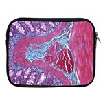 Natural Stone Red Blue Space Explore Medical Illustration Alternative Apple iPad 2/3/4 Zipper Cases Front