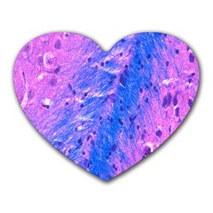 The Luxol Fast Blue Myelin Stain Heart Mousepads