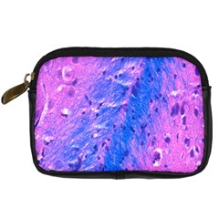 The Luxol Fast Blue Myelin Stain Digital Camera Cases